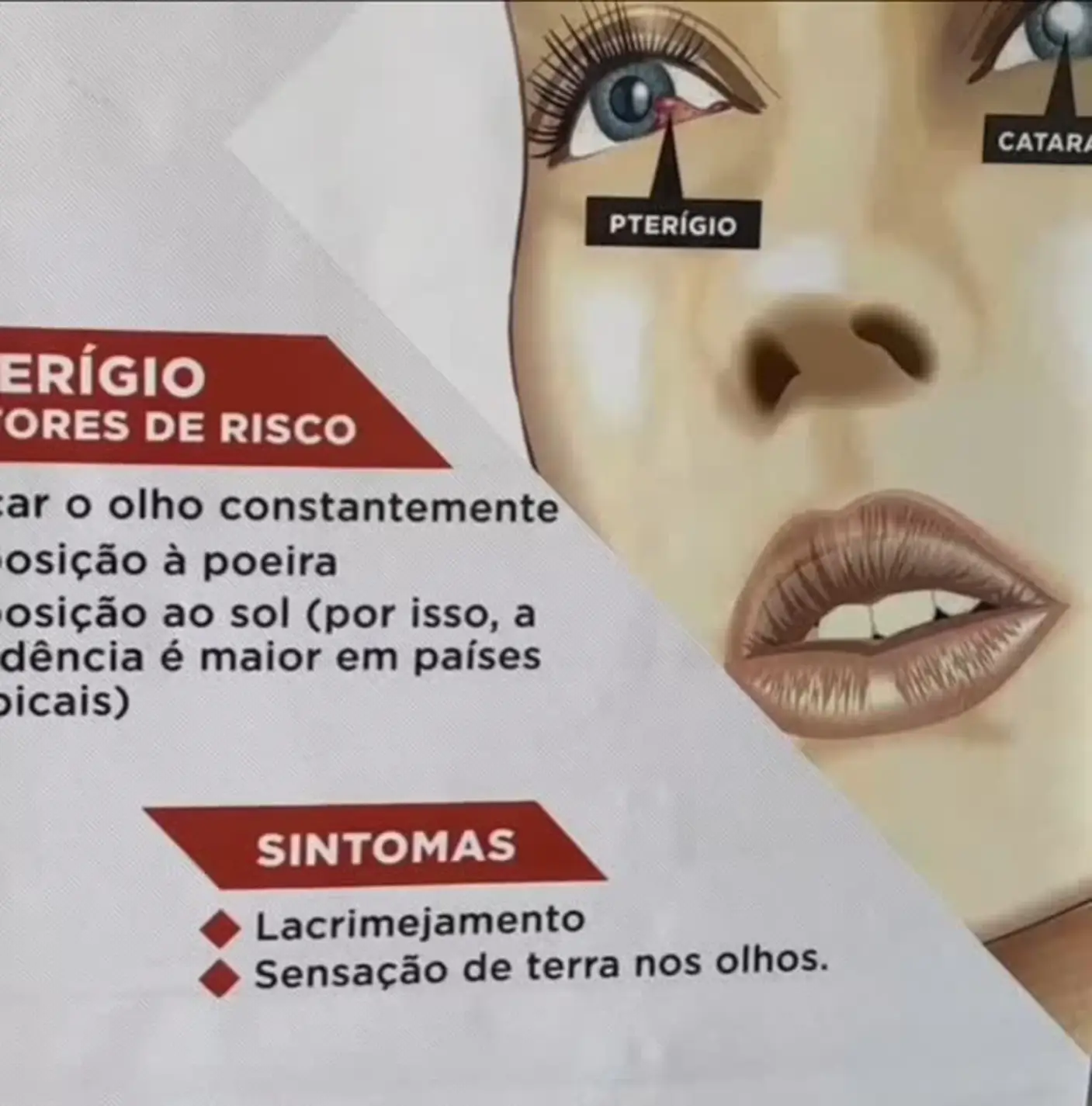 Pré-Cadastros - Semana Saúde Visual